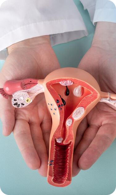 FertLife Clinic - Inseminação intra uterina