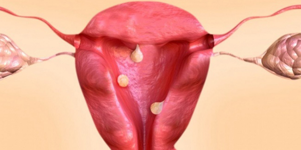 FertLife Clinic - Biópsia Endometrial